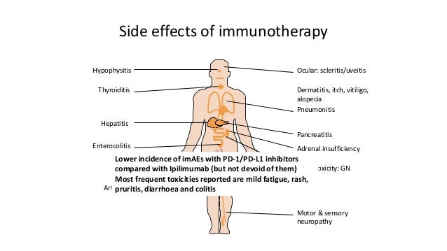 effects of cancer Some of the most common side effects of immunotherapy include fatigue, one of cancer cells' survival strategies is to hide from immune. effects of cancer Some of the most common side effects of immunotherapy include fatigue, one of cancer cells' survival strategies is to hide from immune.